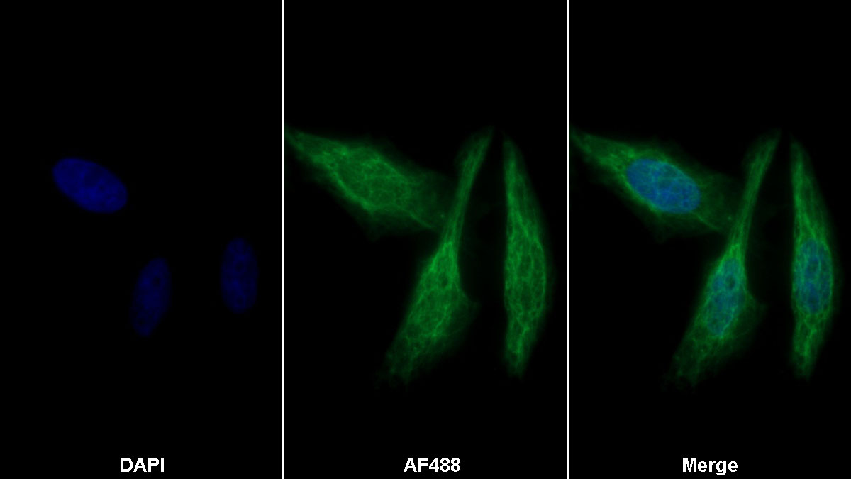 Polyclonal Antibody to Nucleobindin 2 (NUCB2)