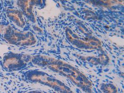 Polyclonal Antibody to Nucleobindin 2 (NUCB2)