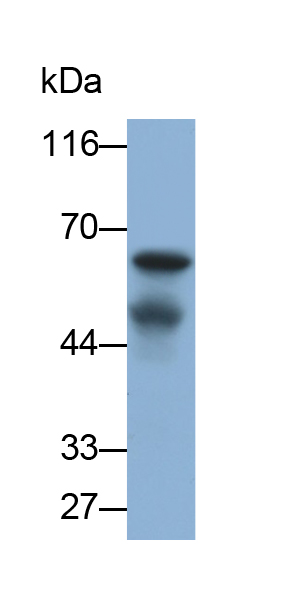 Polyclonal Antibody to Mucin 21 (MUC21)