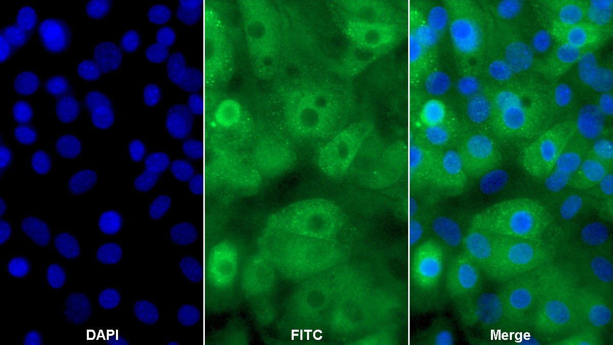 Polyclonal Antibody to Collagen Type II Alpha 1 (COL2a1)