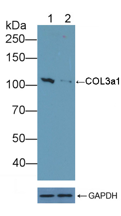 Polyclonal Antibody to Collagen Type III Alpha 1 (COL3a1)