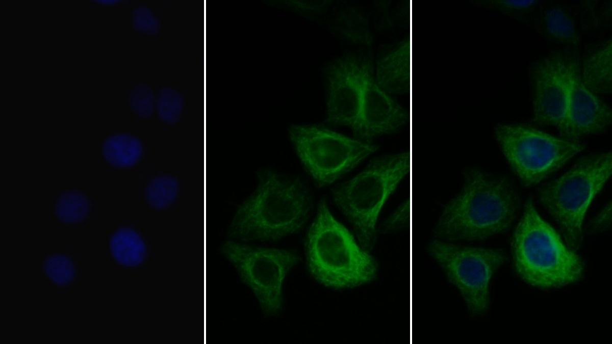 Polyclonal Antibody to Collagen Type III Alpha 1 (COL3a1)