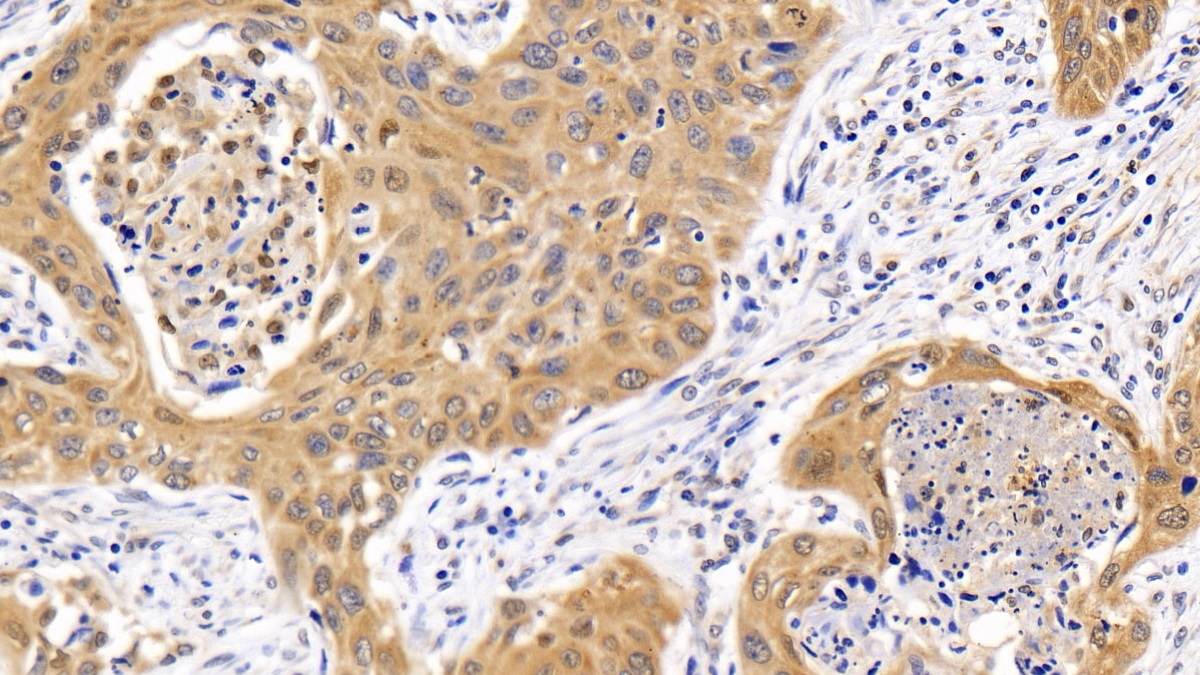 Polyclonal Antibody to Sequestosome 1 (SQSTM1)