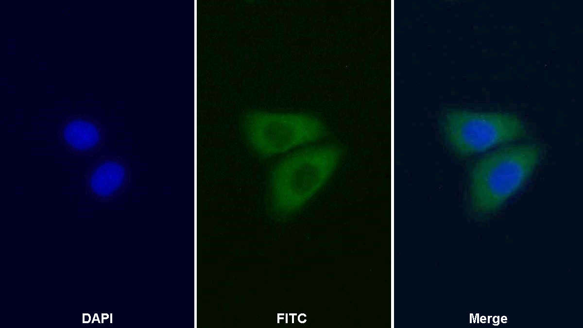 Polyclonal Antibody to Sequestosome 1 (SQSTM1)