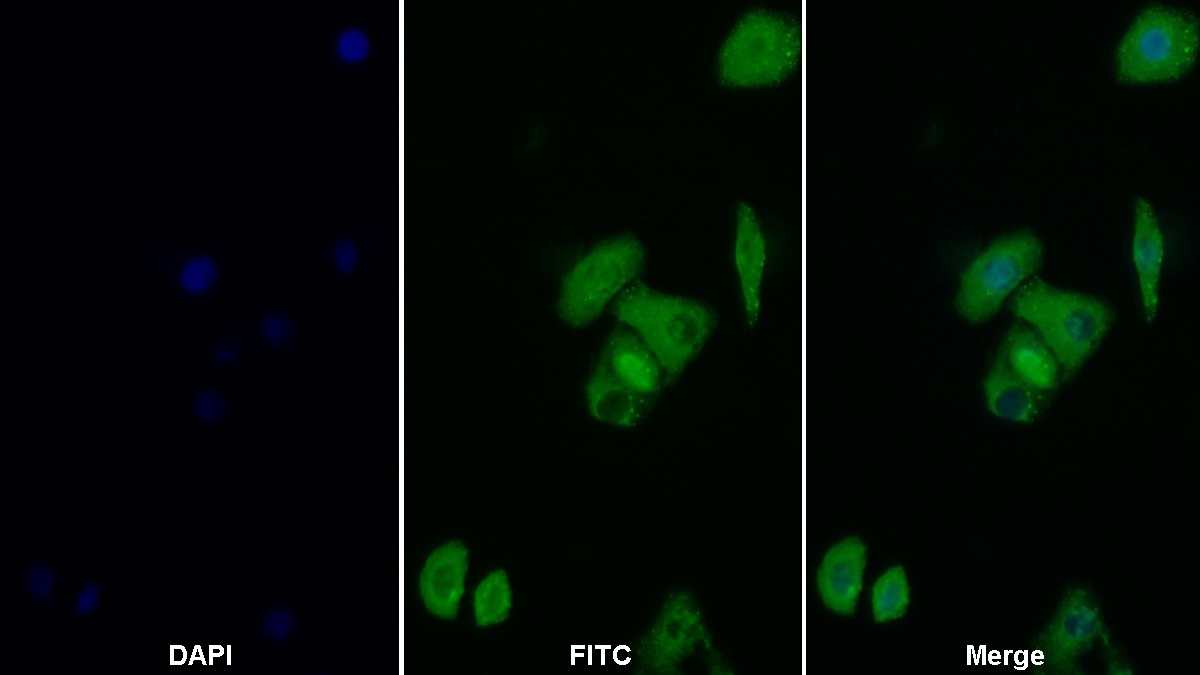 Polyclonal Antibody to Sequestosome 1 (SQSTM1)