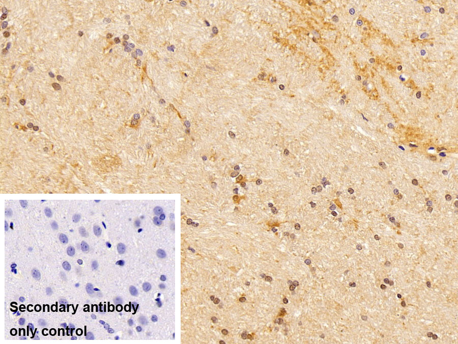 Polyclonal Antibody to Sequestosome 1 (SQSTM1)