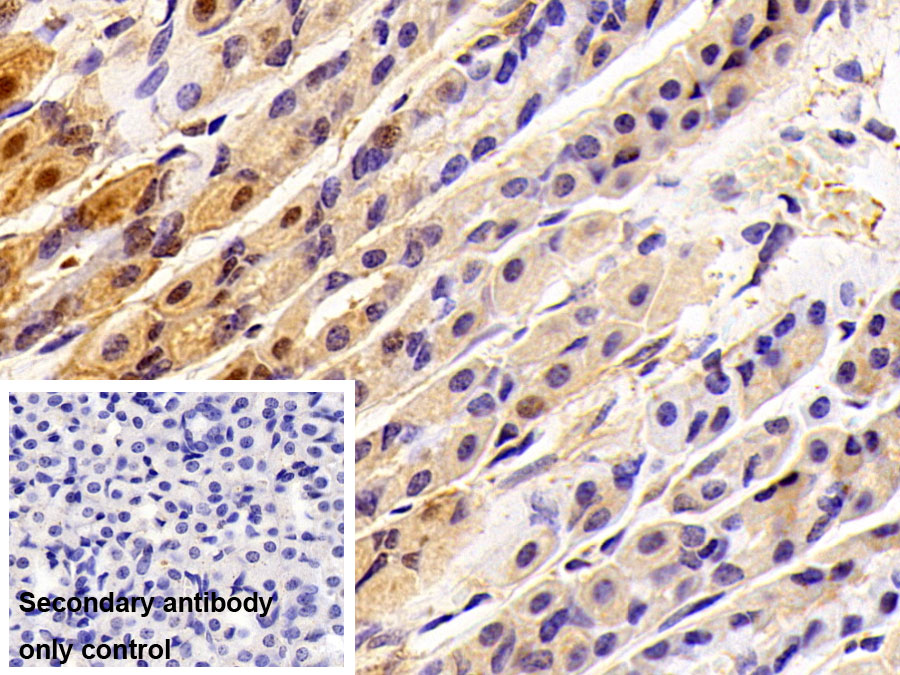 Polyclonal Antibody to Sequestosome 1 (SQSTM1)