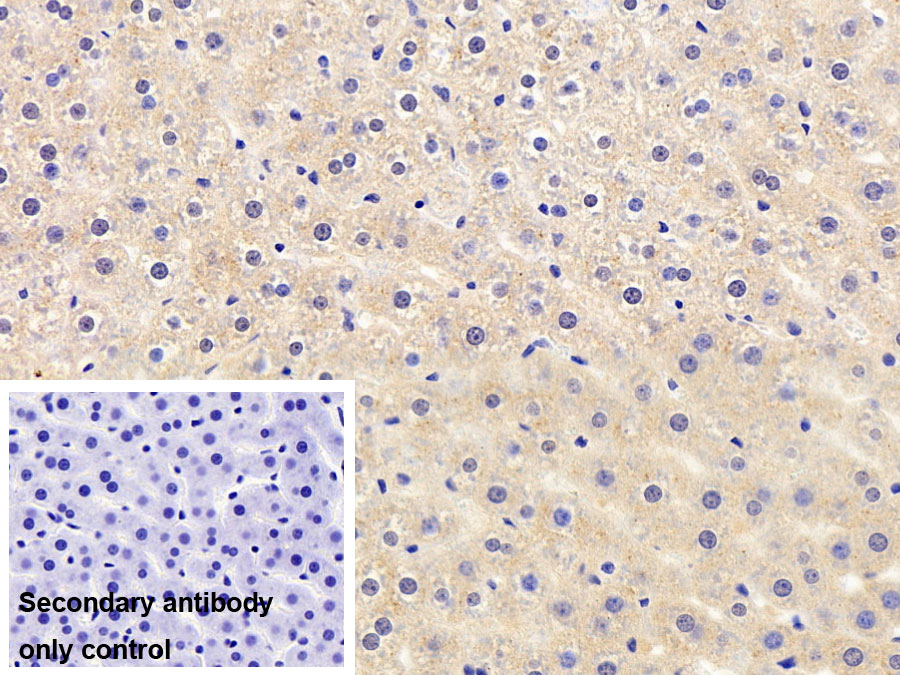 Polyclonal Antibody to Sequestosome 1 (SQSTM1)