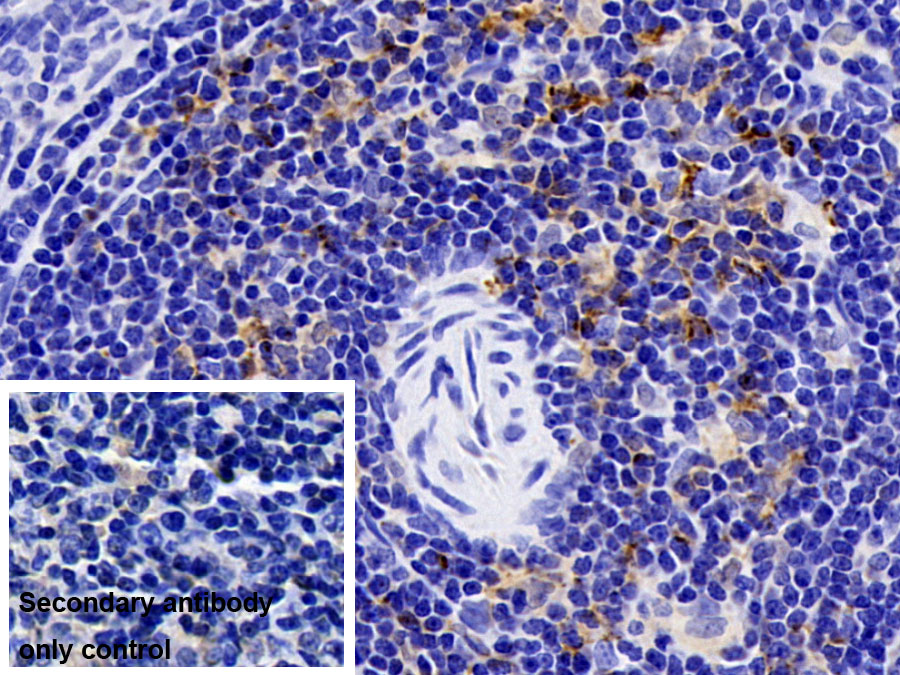 Polyclonal Antibody to Sequestosome 1 (SQSTM1)