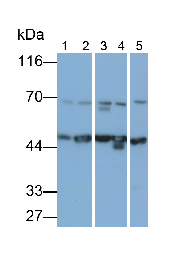 Polyclonal Antibody to Sjogren Syndrome Antigen B (SSB)