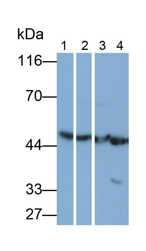 Polyclonal Antibody to Sjogren Syndrome Antigen B (SSB)