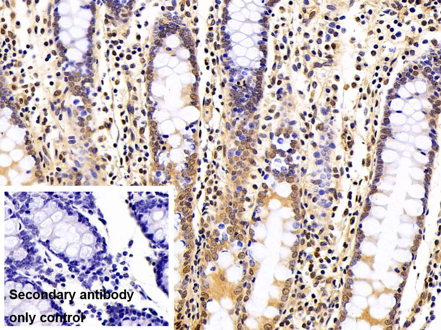 Polyclonal Antibody to Sjogren Syndrome Antigen B (SSB)