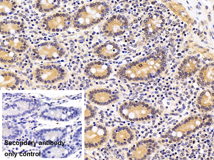 Polyclonal Antibody to Sjogren Syndrome Antigen B (SSB)