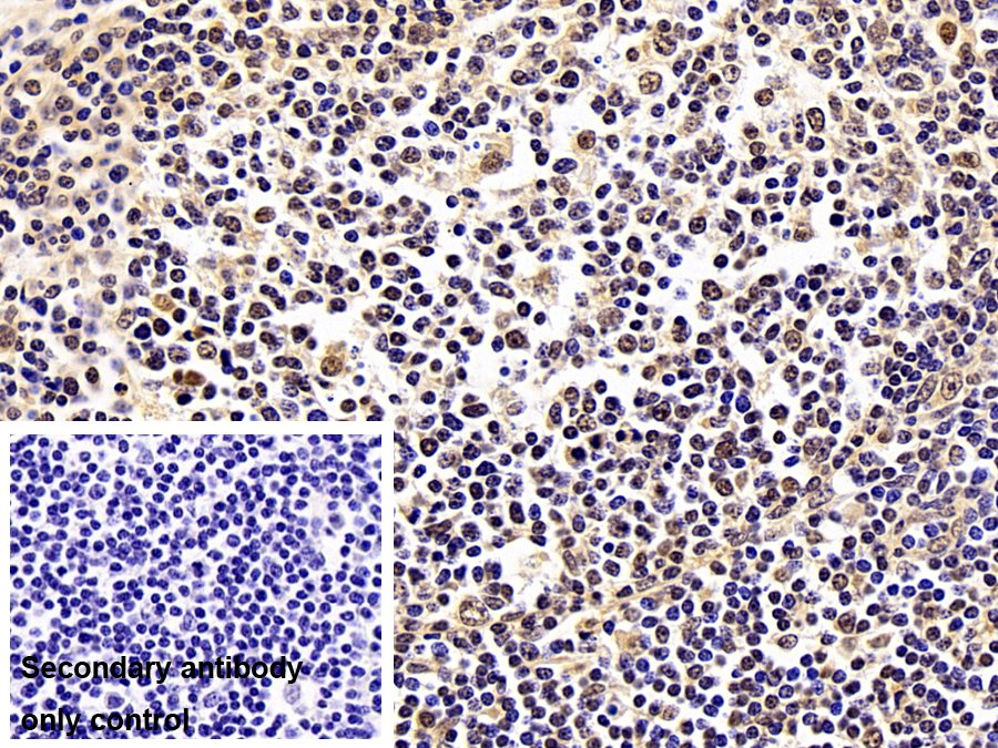 Polyclonal Antibody to Sjogren Syndrome Antigen B (SSB)