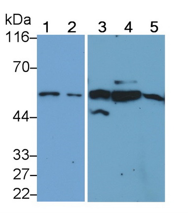 Polyclonal Antibody to Sjogren Syndrome Antigen A1 (SSA1)