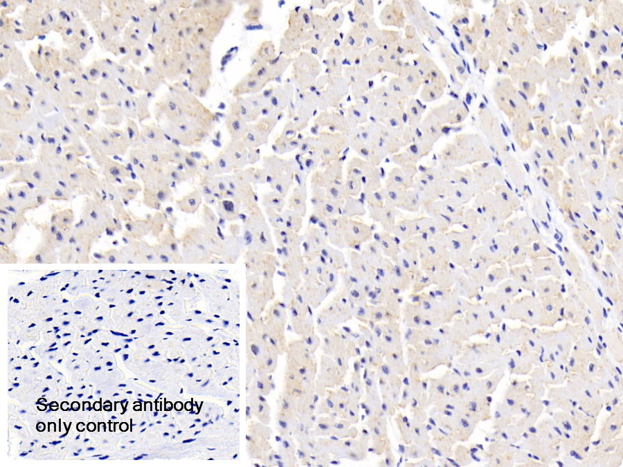 Polyclonal Antibody to Sjogren Syndrome Antigen A1 (SSA1)