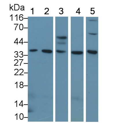 Polyclonal Antibody to Epstein Barr Virus Induced Protein 3 (EBI3)