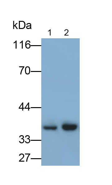 Polyclonal Antibody to Epstein Barr Virus Induced Protein 3 (EBI3)