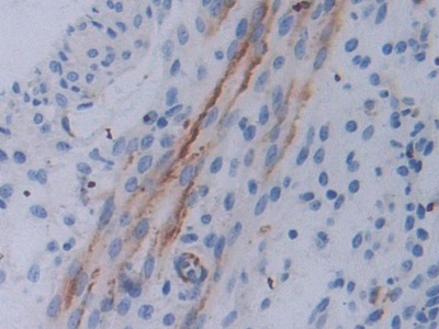 Polyclonal Antibody to Epstein Barr Virus Induced Protein 3 (EBI3)