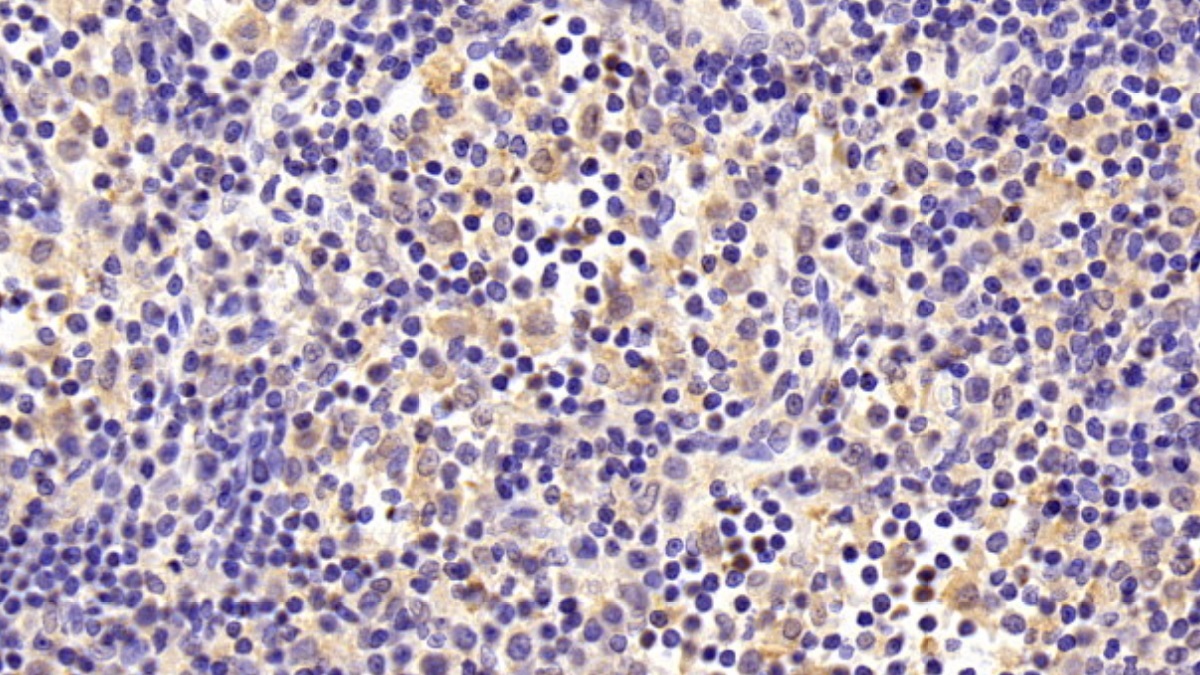 Polyclonal Antibody to Complement Component 1, Q Subcomponent A (C1qA)