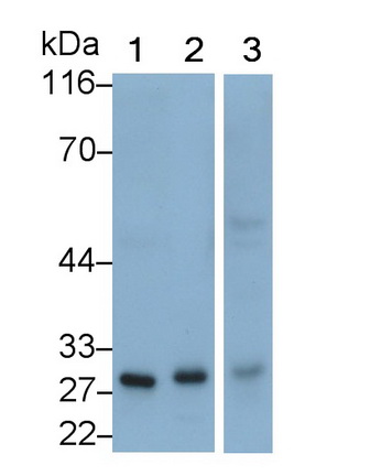 Polyclonal Antibody to Complement Component 1, Q Subcomponent A (C1qA)