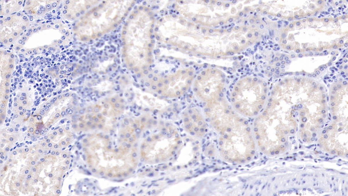 Polyclonal Antibody to Complement Component 1, Q Subcomponent B (C1qB)