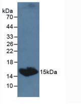 Polyclonal Antibody to Thyroid Stimulating Hormone Beta (TSHb)