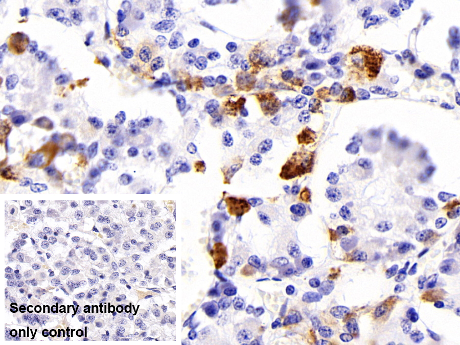 Polyclonal Antibody to Thyroid Stimulating Hormone Beta (TSHb)