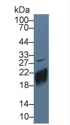 Polyclonal Antibody to Chorionic Gonadotropin Beta Polypeptide (CGb)