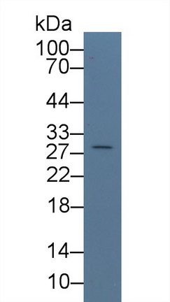 Polyclonal Antibody to Chorionic Gonadotropin Beta Polypeptide (CGb)