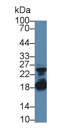 Polyclonal Antibody to Troponin C Type 1, Slow (TNNC1)