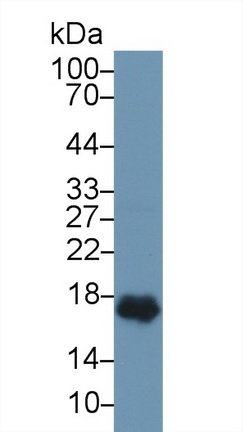 Polyclonal Antibody to Troponin C Type 1, Slow (TNNC1)