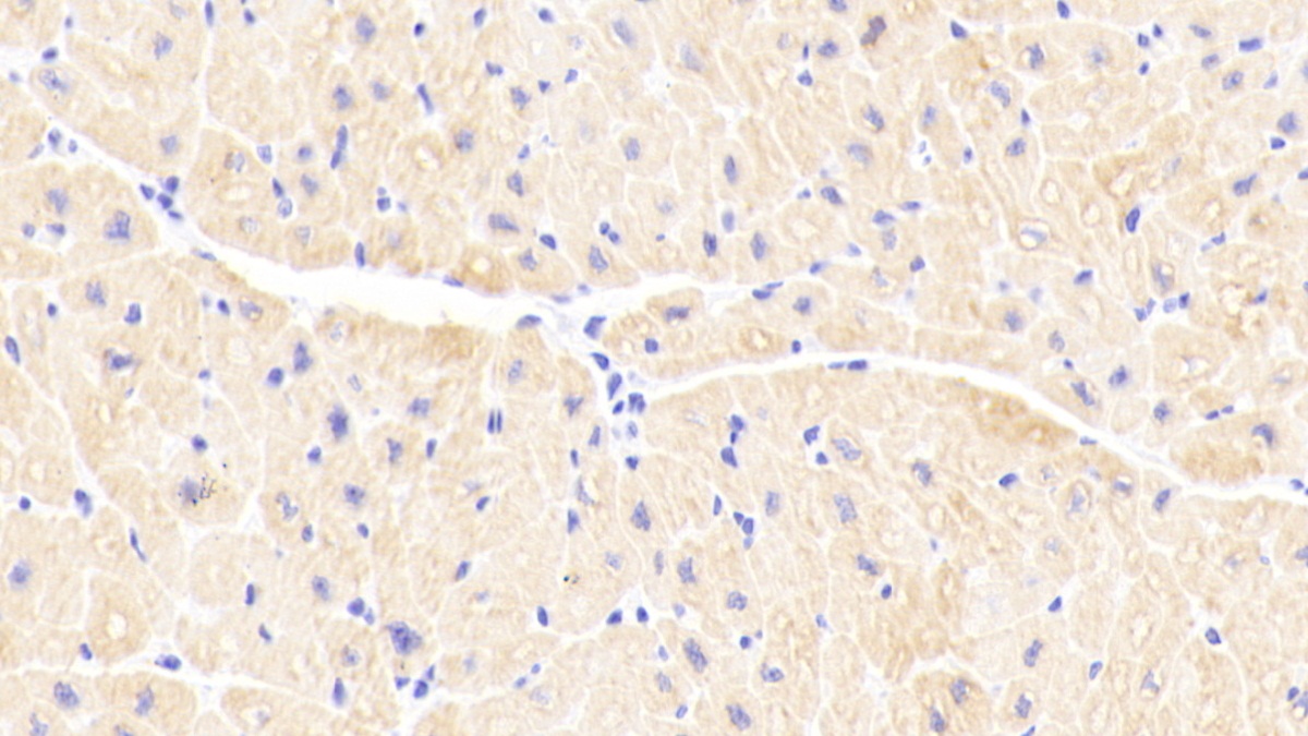 Polyclonal Antibody to Troponin C Type 1, Slow (TNNC1)