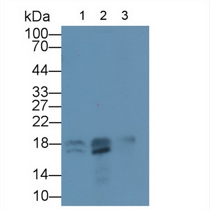 Polyclonal Antibody to Troponin C Type 2, Fast (TNNC2)