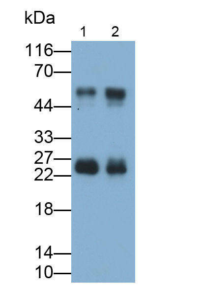 Polyclonal Antibody to Troponin I Type 1, Slow Skeletal (TNNI1)