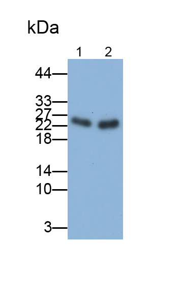 Polyclonal Antibody to Troponin I Type 1, Slow Skeletal (TNNI1)