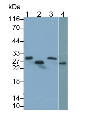 Polyclonal Antibody to Troponin I Type 1, Slow Skeletal (TNNI1)