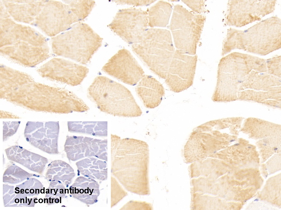 Polyclonal Antibody to Troponin I Type 2, Fast Skeletal (TNNI2)