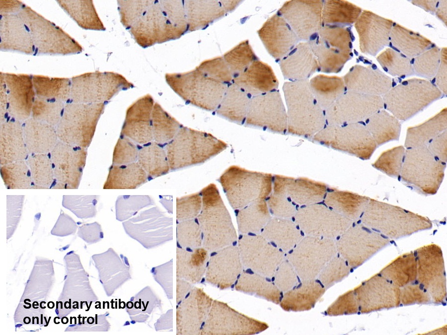 Polyclonal Antibody to Troponin I Type 2, Fast Skeletal (TNNI2)