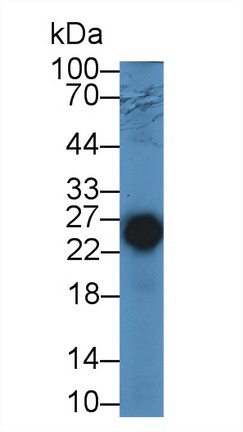 Polyclonal Antibody to Troponin I Type 2, Fast Skeletal (TNNI2)