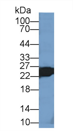 Polyclonal Antibody to Troponin I Type 2, Fast Skeletal (TNNI2)