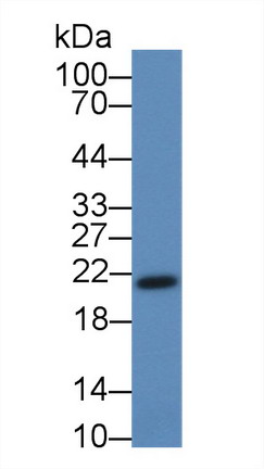 Polyclonal Antibody to Troponin I Type 2, Fast Skeletal (TNNI2)