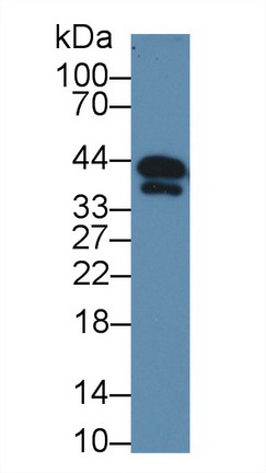 Polyclonal Antibody to Troponin T Type 1, Slow Skeletal (TNNT1)