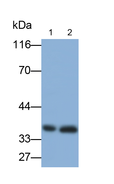 Polyclonal Antibody to Troponin T Type 1, Slow Skeletal (TNNT1)