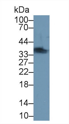 Polyclonal Antibody to Troponin T Type 1, Slow Skeletal (TNNT1)