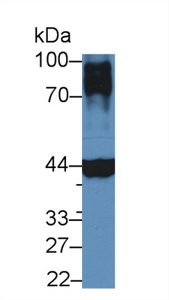 Polyclonal Antibody to Troponin T Type 2, Cardiac (TNNT2)