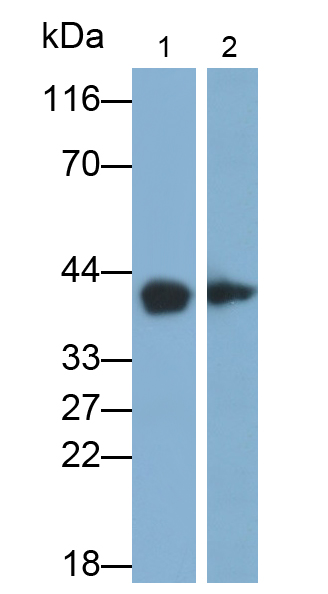 Polyclonal Antibody to Troponin T Type 2, Cardiac (TNNT2)