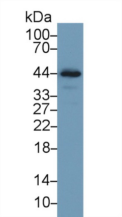 Polyclonal Antibody to Troponin T Type 2, Cardiac (TNNT2)