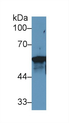 Polyclonal Antibody to Keratin 6A (KRT6A)