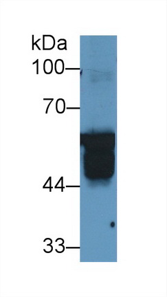 Polyclonal Antibody to Keratin 6A (KRT6A)